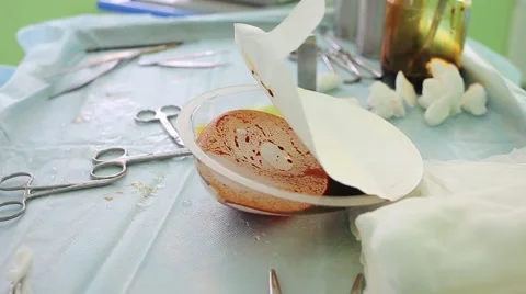 Breast implants filled with a solution before surgery 스톡 동영상 64627298