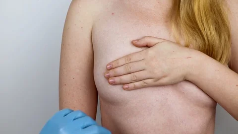 Breast plastic surgery - plastic breast augmentation surgery. The doctor prepare Stock Footage 103657827