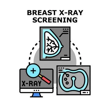 Breast x ray screening concept for mammography examination Stock Illustration