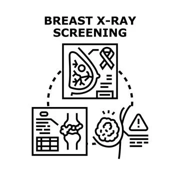 Breast x ray screening detecting cancer and tumor development Stock Illustration