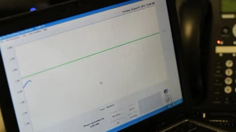 Breath cardiogram Vídeo Stock 12140299