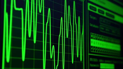 Bright neon green graph showing fluctuating data on a dark computer monitor Stock Footage 320777569