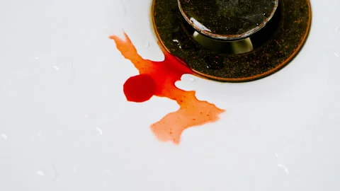 Bright red drops of blood falling into a wet sink basin Stock Footage 284585070
