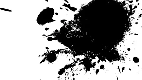 Bright Sunlight Transition Through Trees Stock Footage 319405581