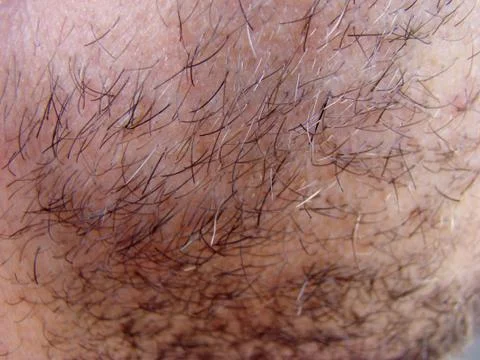 Bristle Stock Photos