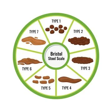 Bristol stool chart with faesces classification vector illustration. Stock Illustration