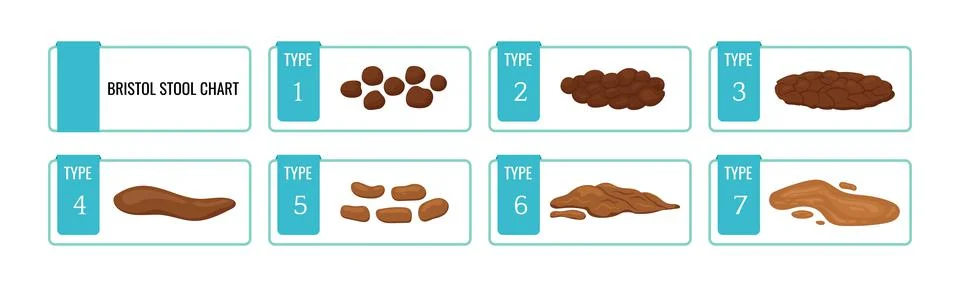 Bristol stool chart scale with faesces structure classification. Illustrazione stock