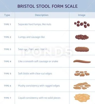 Bristol stool form scale infographic with faeces type flat vector ...