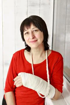 A broken arm. Close-up of the plaster. A lady in a red jacket with a bright m Stockfoto's