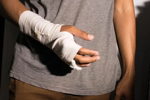 Broken arm Stock Photos