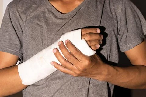 Broken arm Stock Photos