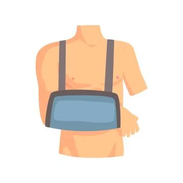 Broken arm with a plaster cast cartoon vector Illustration Stock Illustration