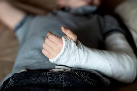 Broken arm with plaster cast Stock Photos