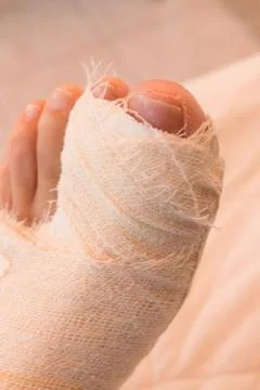 Broken Big Toe Stock Photos