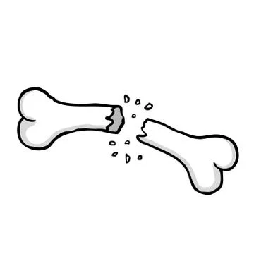 Broken bone Stock Illustration