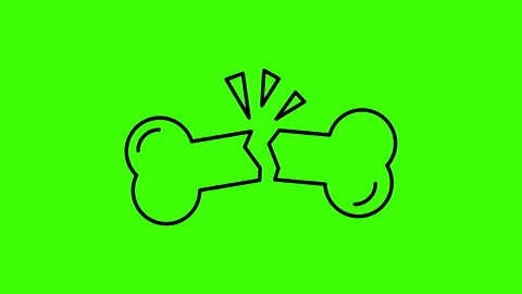 Broken bone line icon motion graphic animation.green background Stock Footage 142950140