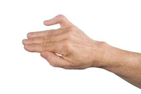 Broken finger Foto stock