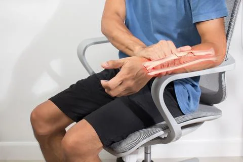 Broken forearm bone Stock Photos