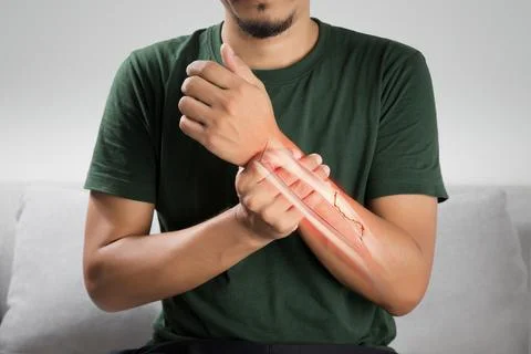 Broken forearm bone Stock Photos