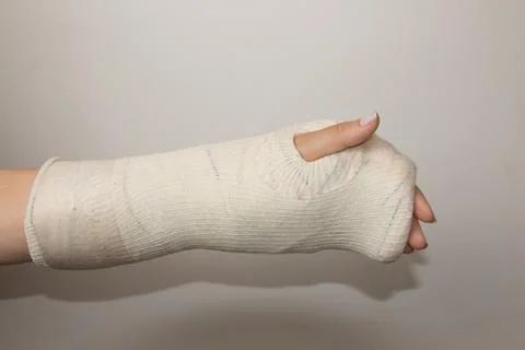 Broken Hand Stock Photos