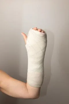 Broken Hand Stock Photos
