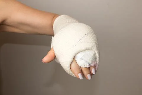 Broken Hand Stock Photos