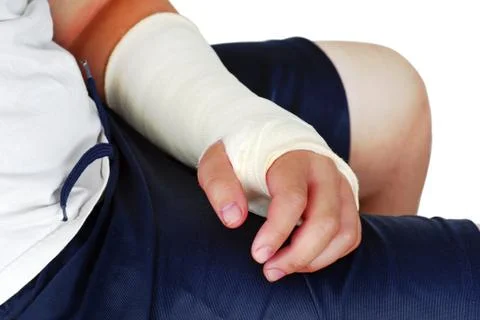 Broken hand in a plaster cast Stock Photos