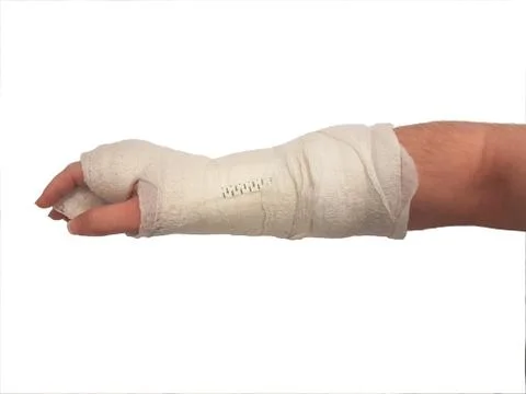 Broken hand plaster. right hand. male. isolated Фото