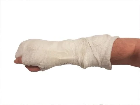 Broken hand plaster. right hand. male. isolated Stock Photos