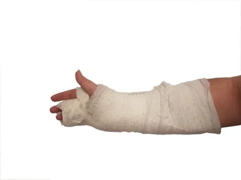Broken hand plaster. right hand. male. isolated Stock Photos