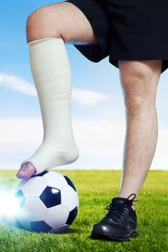 Broken leg Stock Photos