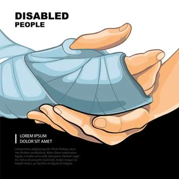 Broken right hand Stock Illustration