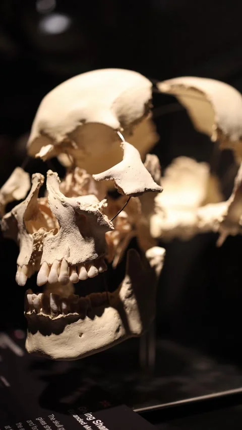 Broken skull anatomy model Stock Footage 331233057