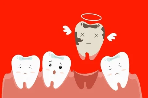 Broken Tooth - Dental Care - Vector Animation - Red - SD Vídeo Stock 95576745