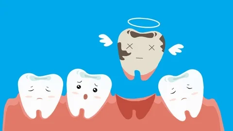 Broken Tooth - Dental Care - Vector Animation - Blue Stock Footage 95576874