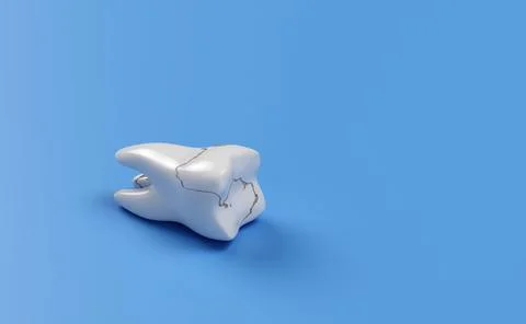 Broken tooth isolated on blue background. 3d render illustration Stock Illustration