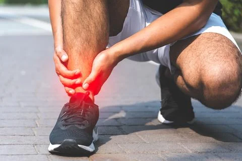 Broken twisted ankle. Runner touching foot in pain due to sprained ankle Foto stock
