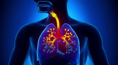 Bronchiolitis - Inflammation of the Bronchioles Stock Footage 42330233