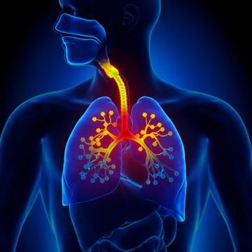 Bronchiolitis - Inflammation of the bronchioles 스톡 일러스트