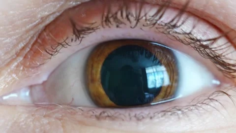 Brown eyes with dilated pupils after ophthalmologist drops Stock Footage 332215372