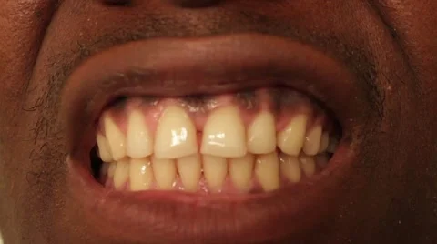 Brown Teeth Stock Footage 50621766