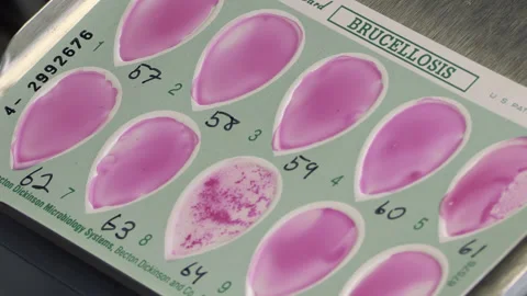 Brucellosis Disease Test Samples Processing Stock Footage 130222893
