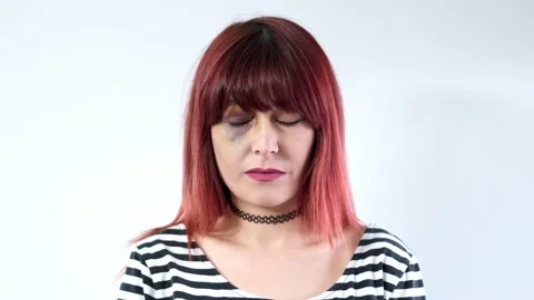 The Bruised Redhead Looks Directly At The Camera. Violence Against Women Stock Footage 142683194