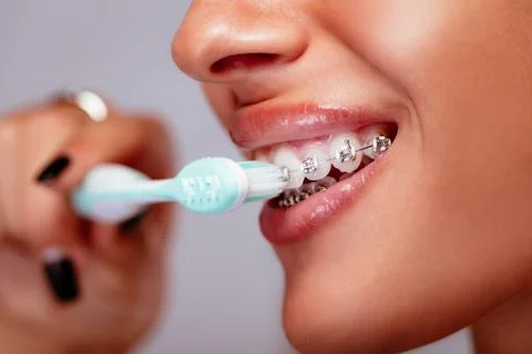 Brushing Teeth With Braces Stock Photos