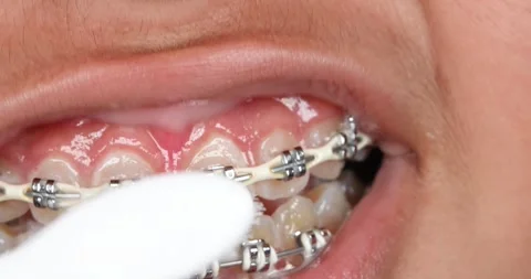 Brushing teeth with sonic electric brush Stock Footage 286762333