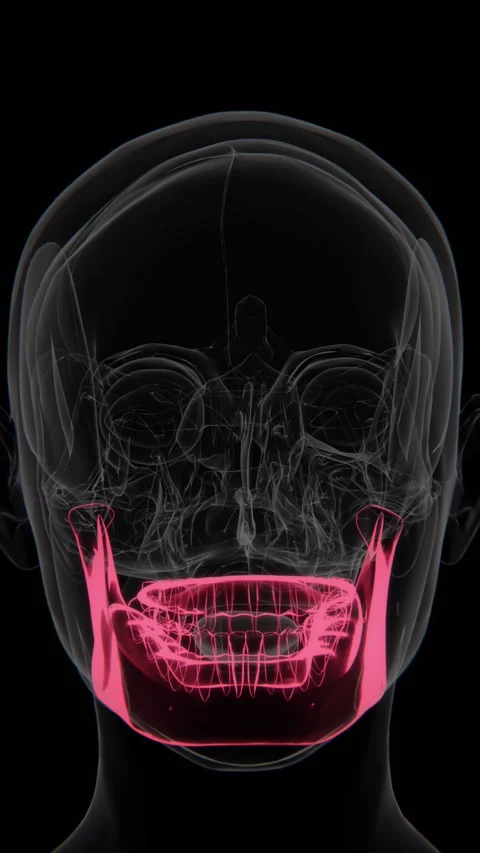 Bruxism is a condition characterized by involuntary teeth grinding or jaw Stock Footage 342303197