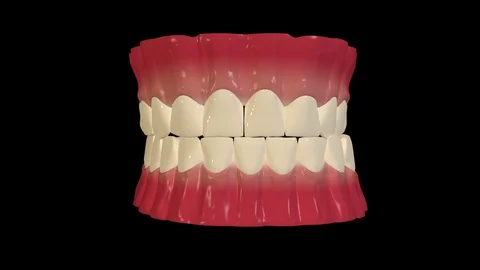 Bruxism Condition Stock Footage 128037981