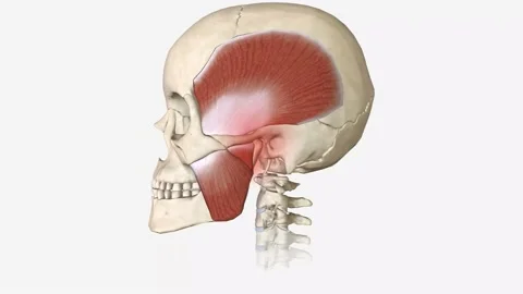 Bruxism is a disorder characterized by abnormal tooth wear due to grinding and Vídeo Stock 230472317