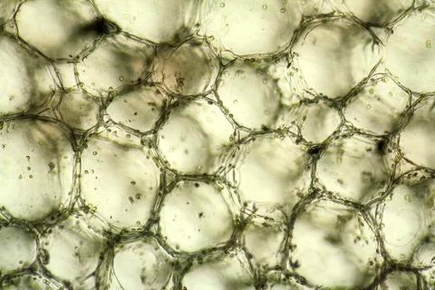 Bryophyllum cell structure Stock Photos