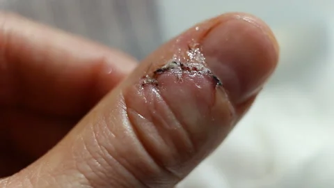 Bubbles, hydrogen, peroxide, bubbles, foam, biological, fluids, antiseptic, disi Stock Footage 143749821